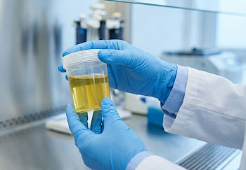 Eine Urinprobe zum Feststellen von Bakterien im Urin wird im Labor untersucht.